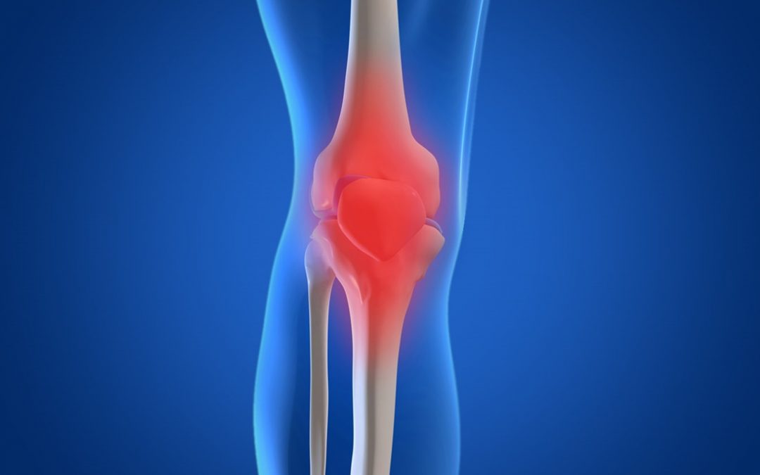 Osteoarthritis: what is it?