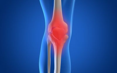 Osteoarthritis: what is it?